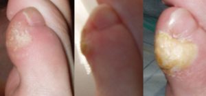feet
