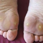 feet